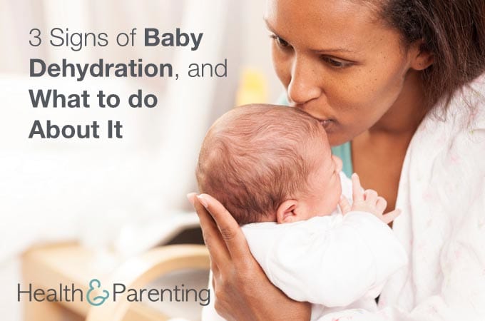 signs of dehydration in babies