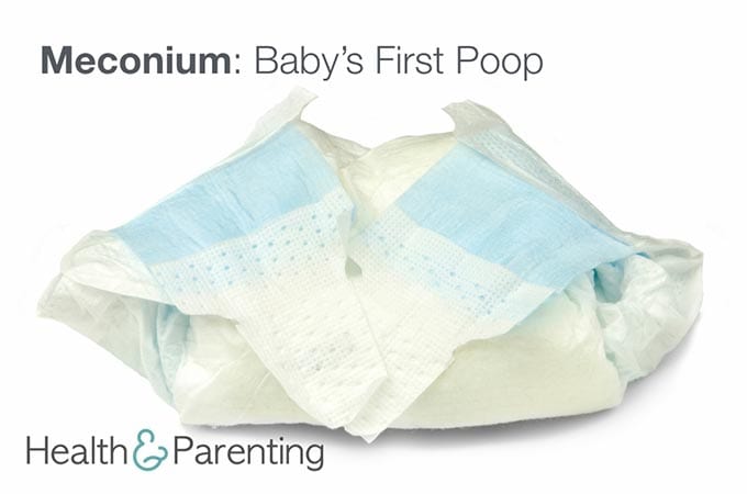 Meconium: Your Baby's First Bowel Movement