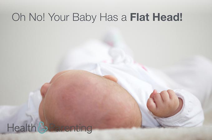 Oh No! Your Baby Has a Flat Head!
