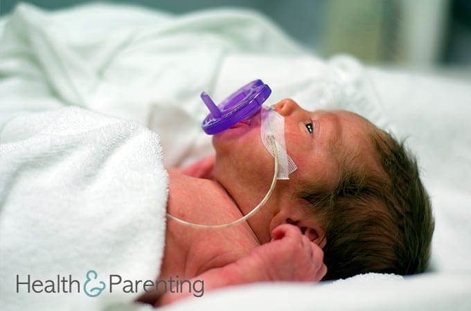 Premature Labor and How to Avoid It