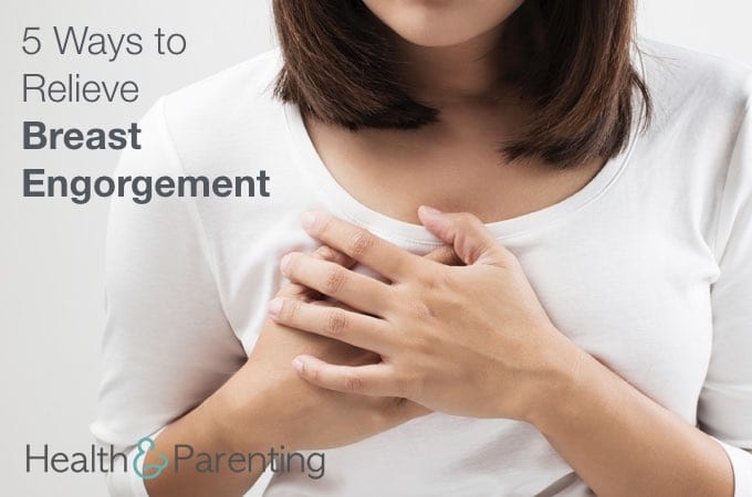 5 Ways to Relieve Breast Engorgement