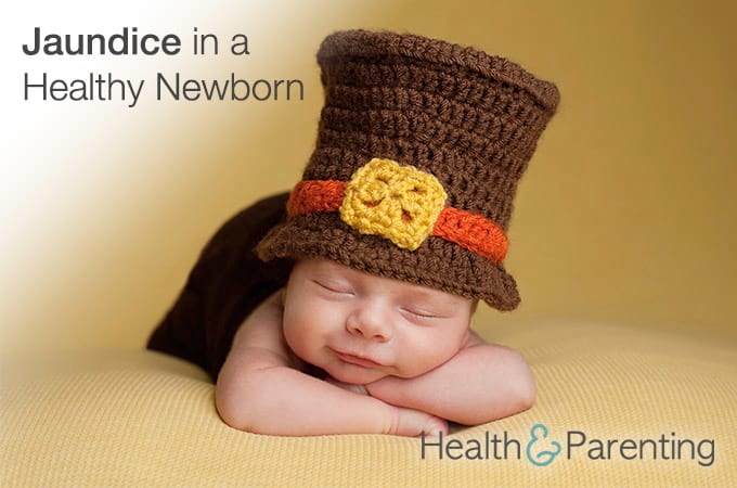 Jaundice in a Healthy Newborn: Should I Worry?