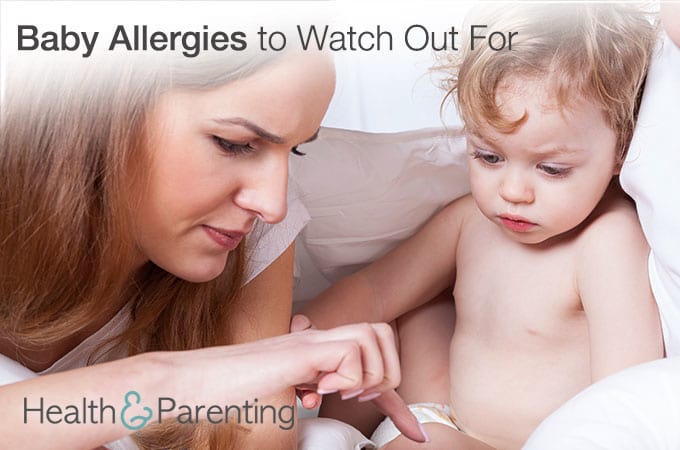 5 Baby Allergies to Watch Out For