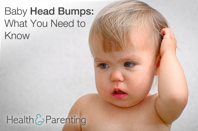 Baby Head Bumps: What You Need to Know