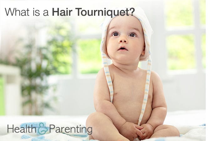 What is a Hair Tourniquet?