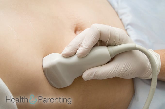 Symptome einer extra-uterinen Schwangerschaft