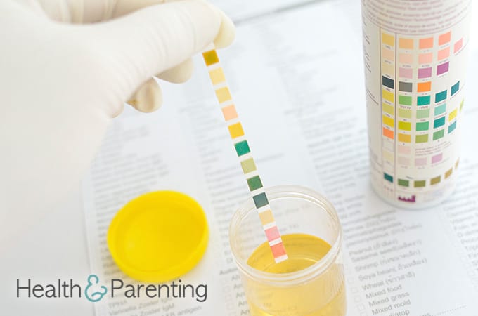 Blood clots in urine during pregnancy