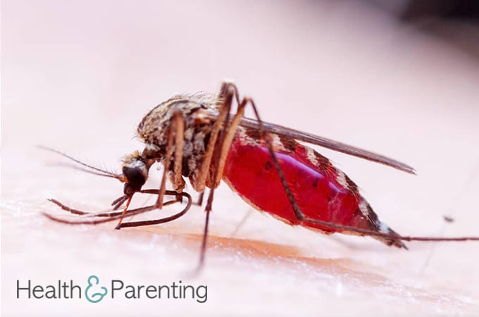 Zika and Pregnancy
